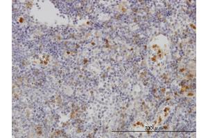 Immunoperoxidase of monoclonal antibody to FGR on formalin-fixed paraffin-embedded human lymph node. (Fgr antibody  (AA 1-90))