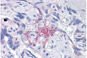 Anti-BUB1B / BubR1 antibody IHC staining of human placenta. (BUB1B antibody  (AA 1-130))