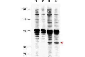 Western blot using  affinity purified anti-FANCF antibody shows detection of FANCF present in a lysate prepared from a Fanconi anemia complementation group F patient lymphoblast after retroviral correction using hFANCF cDNA (lanes 3 and 4). (FANCF antibody  (Internal Region))