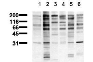 Western Blotting (WB) image for anti-Phosphotyrosine antibody (ABIN126879)