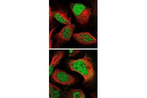 Immunofluorescent staining of human cell line U-2 OS with PPP1R26 polyclonal antibody  at 1-4 ug/mL dilution shows positivity in nucleus. (PPP1R26 antibody)