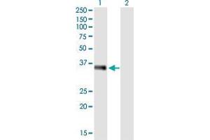 Western Blotting (WB) image for anti-Estrogen Receptor Binding Site Associated, Antigen, 9 (EBAG9) (AA 1-213) antibody (ABIN522624)