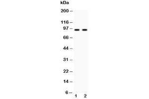 Western blot testing of Cadherin 17 antibody and Lane 1:  HeLa (LI Cadherin antibody  (AA 686-699))
