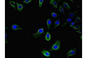 Immunofluorescent analysis of Hela cells using ABIN7174530 at dilution of 1:100 and Alexa Fluor 488-congugated AffiniPure Goat Anti-Rabbit IgG(H+L) (UBA6 antibody  (AA 1-44))