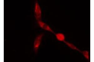 ABIN6274261 staining A549 cells by IF/ICC. (ZFP36L2 antibody  (Internal Region))