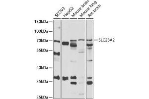 Western blot analysis of extracts of various cell lines, using SLC23 antibody (ABIN6133021, ABIN6147898, ABIN6147899 and ABIN6222467) at 1:1000 dilution. (SLC23A2 antibody  (AA 1-90))