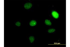 Immunofluorescence of monoclonal antibody to TBX2 on HeLa cell. (TBX2 antibody  (AA 603-702))