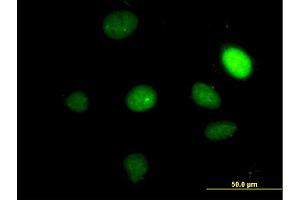 Immunofluorescence of monoclonal antibody to TBX2 on HeLa cell.