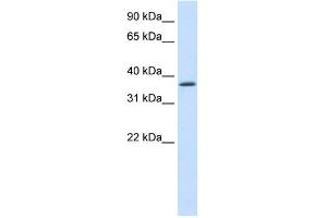 WB Suggested Anti-SAP30BP Antibody Titration:  1. (SAP30BP antibody  (C-Term))