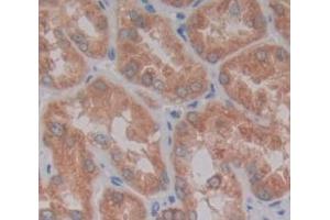 Used in DAB staining on fromalin fixed paraffin- embedded Kidney tissue (SPRED2 antibody  (AA 1-418))