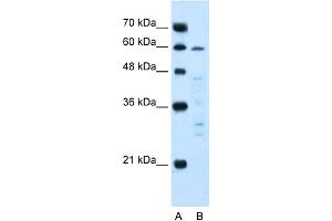 WB Suggested Anti-IL10RA Antibody Titration:  5. (IL-10RA antibody  (N-Term))