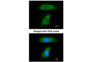 ICC/IF Image Immunofluorescence analysis of paraformaldehyde-fixed HeLa, using B-cell linker protein, antibody at 1:200 dilution. (B-Cell Linker antibody  (C-Term))