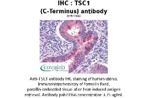 Image no. 2 for anti-Tuberous Sclerosis 1 (TSC1) (C-Term) antibody (ABIN1740408) (TSC1 antibody  (C-Term))