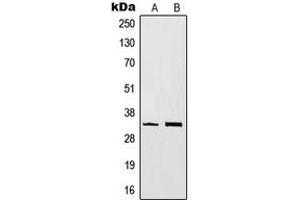 Western blot analysis of CD20 expression in BJAB (A), Ramos (B) whole cell lysates. (CD20 antibody  (C-Term))