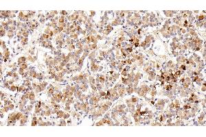 Detection of PRL in Porcine Pituitary Tissue using Polyclonal Antibody to Prolactin (PRL) (Prolactin antibody  (AA 1-226))