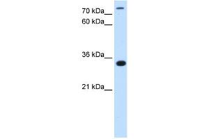 WB Suggested Antibody Titration:  2. (TAM41 antibody  (N-Term))