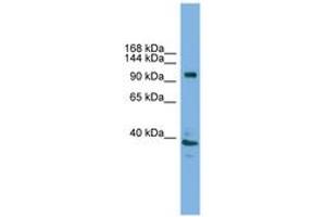 ATP6V0A1 anticorps  (AA 671-720)