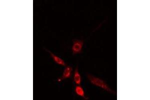ABIN6275698 staining  HepG2 cells by IF/ICC. (SLC30A9 antibody  (Internal Region))