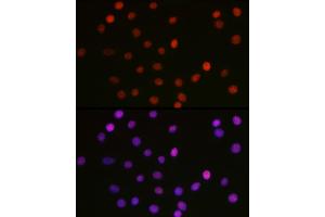Immunofluorescence (IF) image for anti-High Mobility Group Box 1 (HMGB1) (acLys29) antibody (ABIN7267647)