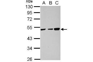 WB Image Sample (30 ug of whole cell lysate) A: 293T B: HeLa C: HepG2 10% SDS PAGE antibody diluted at 1:1000 (TXNDC5 antibody)