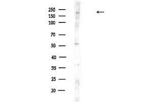 Western blot analysis of lysates from HUVEC cells(UV,30 min treatment), using Spt6 Antibody at 1/1000 dilution.