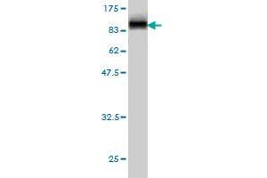 Western Blot detection against Immunogen (89. (Radixin antibody  (AA 1-583))