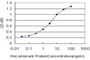 Detection limit for recombinant GST tagged UMPS is approximately 0. (UMPS antibody  (AA 381-479))