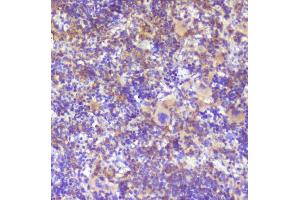 IHC analysis of RP2 using anti-RP2 antibody (ABIN6719513). (RP2 antibody  (AA 244-348))