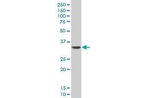 DLX5 monoclonal antibody (M12), clone 3B11 Western Blot analysis of DLX5 expression in A-431 . (DLX5 antibody  (AA 191-279))