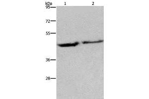 Western Blot analysis of Human adrenal pheochromocytoma and fetal brain tissue using EIF3H Polyclonal Antibody at dilution of 1:1150 (EIF3H antibody)