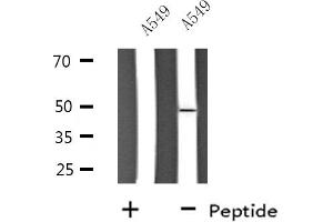 Western blot analysis of extracts from A549 cells, using SLC30A4 antibody. (SLC30A4 antibody  (Internal Region))