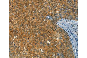 Immunohistochemistry (IHC) image for anti-DIRAS Family, GTP-Binding RAS-Like 1 (DIRAS1) antibody (ABIN2432953) (DIRAS1 antibody)