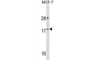 Western Blotting (WB) image for anti-Cyclin-Dependent Kinase 2 Associated Protein 2 (CDK2AP2) antibody (ABIN3000904)