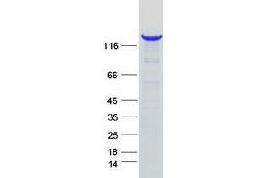 Validation with Western Blot