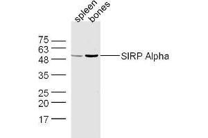 Mouse spleen and bone lysates probed with Rabbit Anti-SIRP Alpha Polyclonal Antibody, Unconjugated  at 1:500 for 90 min at 37˚C. (SIRPA antibody  (AA 151-250))