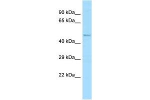 WB Suggested Anti-Abi1 Antibody Titration: 1.