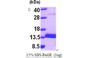 SDS-PAGE (SDS) image for Myotrophin (MTPN) (AA 1-118) protein (His tag) (ABIN667144)
