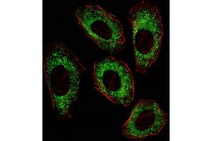 Fluorescent image of A549 cell stained with SRC Antibody (ABIN387822 and ABIN2843908)/SD41014A. (Src antibody)