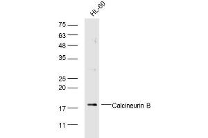 Human HL-60 cells probed with Calcineurin B Polyclonal Antibody, unconjugated  at 1:300 overnight at 4°C followed by a conjugated secondary antibody at 1:10000 for 90 minutes at 37°C. (Calcineurin B/Pp2b-B1 (AA 31-130) antibody)