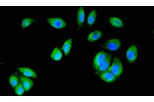 Immunofluorescent analysis of A549 cells using ABIN7146988 at dilution of 1:100 and Alexa Fluor 488-congugated AffiniPure Goat Anti-Rabbit IgG(H+L) (CTNND1 antibody  (AA 482-605))