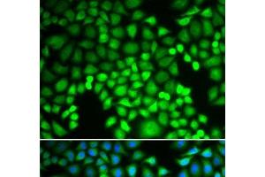 Immunofluorescence analysis of U2OS cells using PSMA4 Polyclonal Antibody (PSMA4 antibody)
