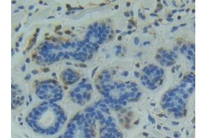 Immunohistochemistry (IHC) image for anti-Glycogen Synthase Kinase 3 alpha (GSK3a) (AA 115-409) antibody (ABIN1859082)