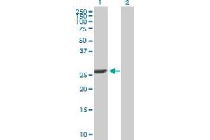Western Blot analysis of DCK expression in transfected 293T cell line by DCK MaxPab polyclonal antibody. (DCK antibody  (AA 1-260))