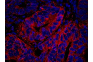 anti-Protein Tyrosine Phosphatase G1 (PTPN12) (AA 760-780) antibody