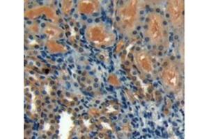 Figure. (GREM1 antibody  (AA 26-184))