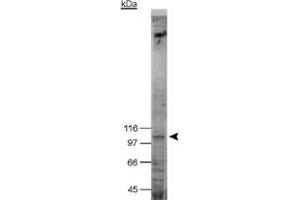 Western blot analysis of NOD2 in NOD2 transfected HEK 293T (Bosc 23) cell lysate with NOD2 monoclonal antibody, clone 2D9 . (NOD2 antibody  (AA 28-301))