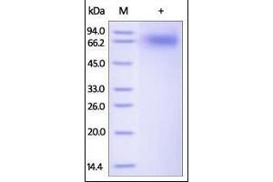 Human TrkB, His Tag on SDS-PAGE under reducing (R) condition. (TRKB Protein (AA 32-430) (His tag))