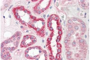 Image no. 2 for anti-Plastin 3 (PLS3) (AA 503-552) antibody (ABIN6749763) (Plastin 3 antibody  (AA 503-552))