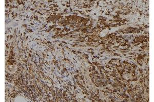 ABIN6273396 at 1/100 staining Human spleen tissue by IHC-P. (SLC5A5 antibody  (Internal Region))