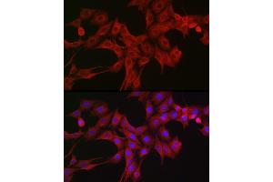 Immunofluorescence analysis of PC-12 cells using LTBR Rabbit pAb (ABIN6129412, ABIN6143379, ABIN6143381 and ABIN6220987) at dilution of 1:200 (40x lens). (LTBR antibody  (AA 31-227))